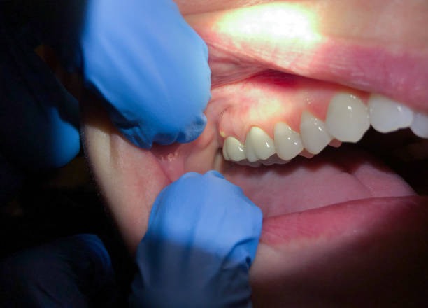Best Dentist for Dental Trauma  in Roseville, MN